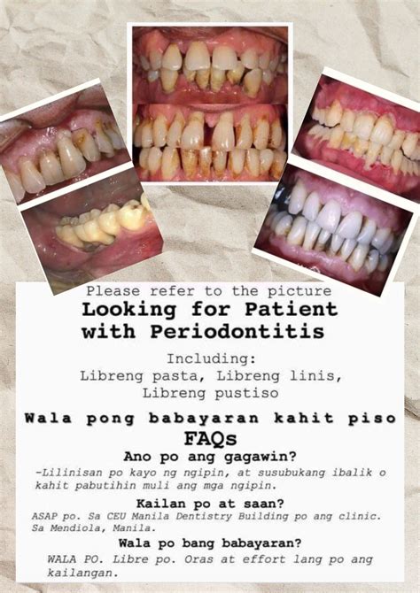 LIBRENG PAAYOS NG NGIPIN .
